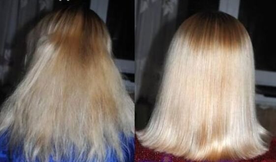 Before and after the hair restore